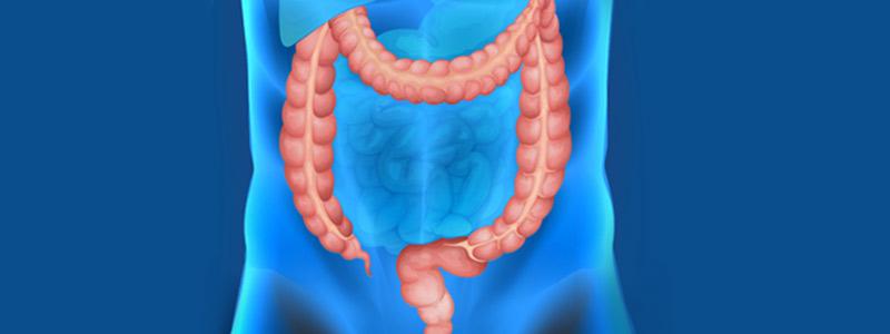 Infografica dei fattori che influenzano il microbiota intestinale