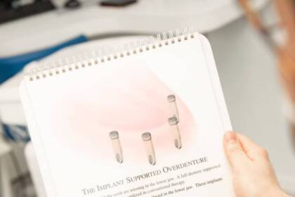 Impianto dentale a Busto Arsizio: una scelta consapevole per la salute del sorriso