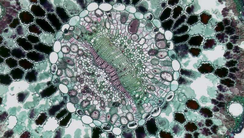 Immagine di un batterio botulino al microscopio